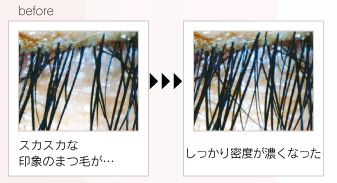 �X�y�V�����v���~�A���A�C���b�V���G�b�Z���X���R�~���ʏ��