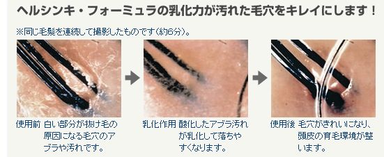 �w���V���L�E�t�H�[�~�����̌��ʁA���\�A���R�~