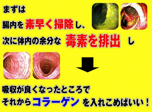 �W�F�g�b�N�X�̌��ʁA���\�A���R�~