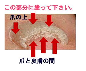 �ܐ����̓h���@�N���A�l�C���̌��ʁA���\�A���R�~