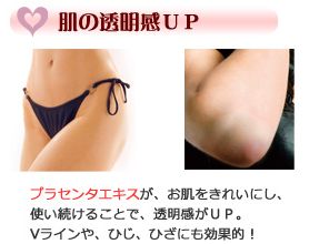 �G�`�P�b�g�v���[�t���R�~
